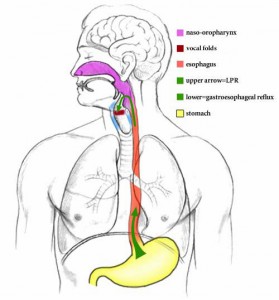 Acid Reflux Specialist in Los Angeles