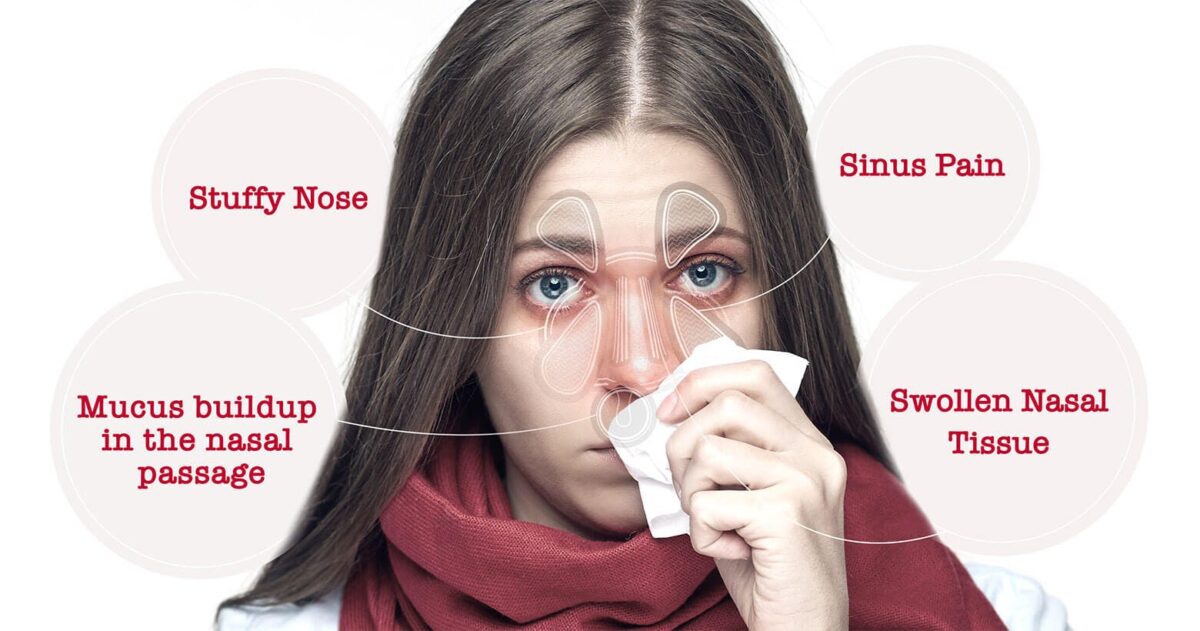 buckleys-article-1-nasal-congestion-2nd-image-canada-desktop-1-1200x631.jpg