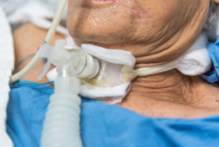Reasons for a Tracheostomy